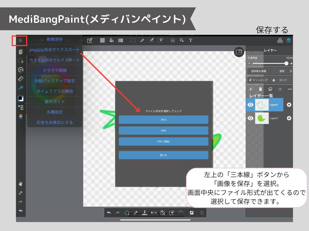 メディバン　保存
